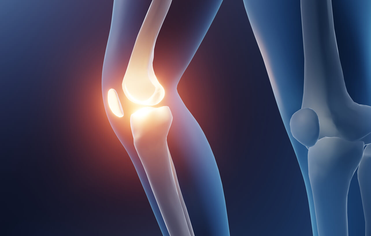 Meniscus Tears