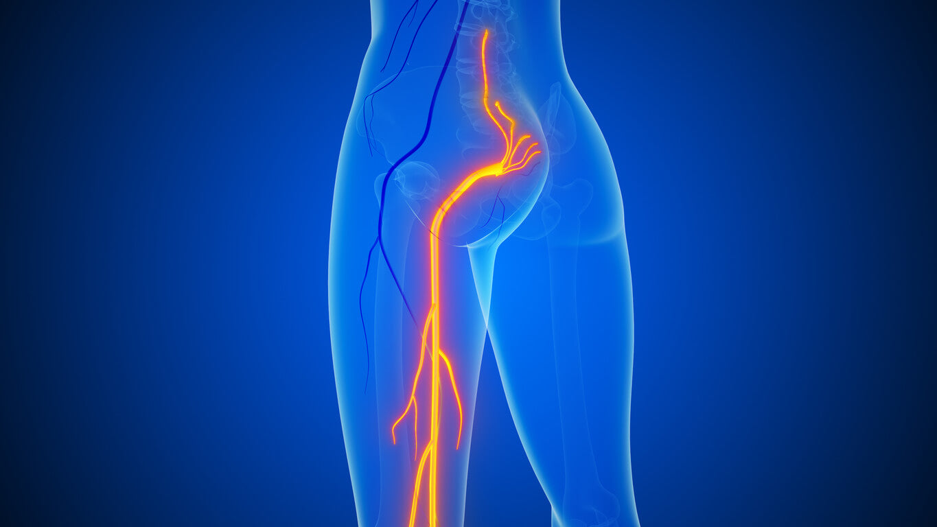 Sciatica & Nerve Pain