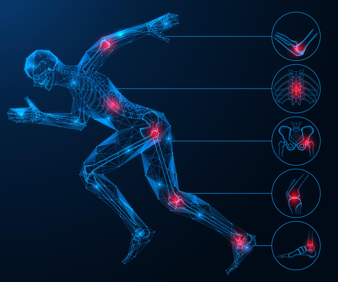 Sports Injuries
